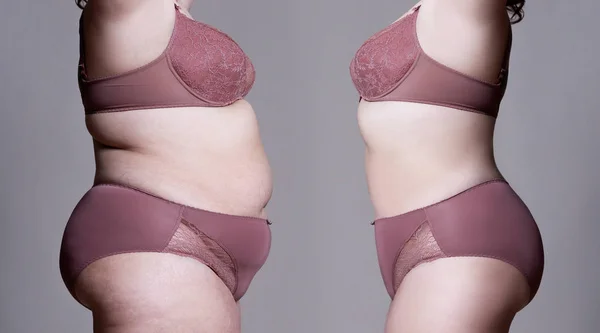 Жирне тіло жінки до і після схуднення — стокове фото