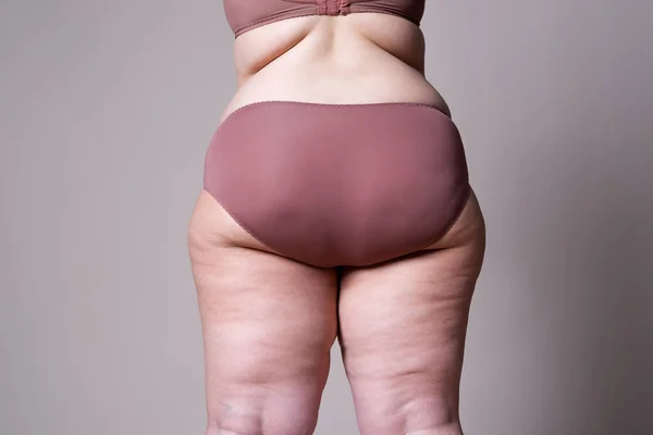 Mulher com excesso de peso com pernas gordas e nádegas, corpo feminino obesidade — Fotografia de Stock