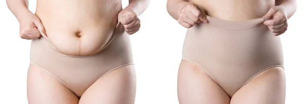 Corps de la femme avant et après la perte de poids, ventre flasque après la grossesse, grosse femme en culotte correctrice isolée sur fond blanc — Photo