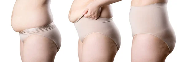 Cuerpo de la mujer antes y después de la pérdida de peso, mujer gorda en bragas correctivas aisladas sobre fondo blanco — Foto de Stock