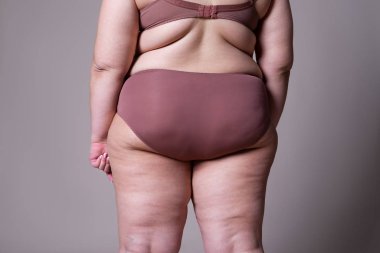 Kilolu kadın şişko bacak ve kalça, obezite kadın bedeni ile