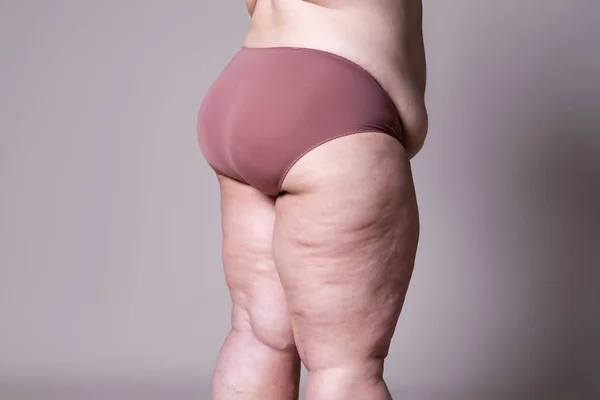 Overweight woman with fat legs and buttocks, obesity female body