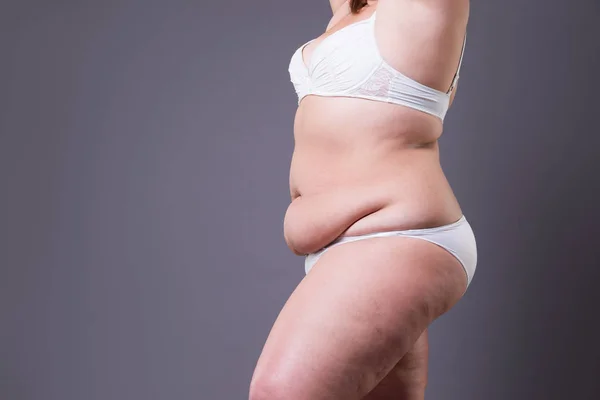 Abdominoplastia, piel flácida en un vientre gordo, concepto de cirugía plástica —  Fotos de Stock