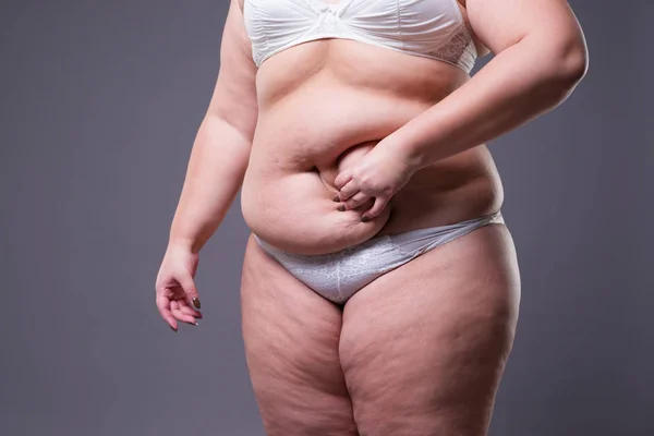 Tummy tuck, pele flácida em uma barriga gorda, conceito de cirurgia plástica — Fotografia de Stock