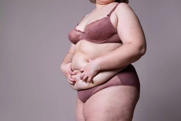 Abdominoplastia, piel flácida en un vientre gordo, concepto de cirugía plástica — Foto de Stock