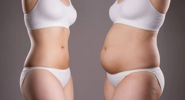 Kvinnans kropp före och efter viktminskning på grå bakgrund — Stockfoto