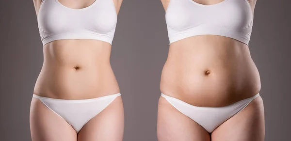 Corpo da mulher antes e depois da perda de peso no fundo cinza — Fotografia de Stock