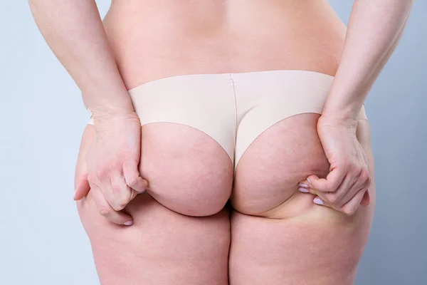 Şişman kalçaları ve kalçaları olan şişman bir kadın, gri arka planda obez bir kadın vücudu. — Stok fotoğraf