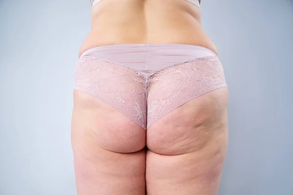 Mulher com excesso de peso com quadris e nádegas gordas, corpo feminino obesidade em fundo cinza — Fotografia de Stock