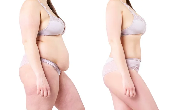 Cuerpo de la mujer antes y después de la pérdida de peso aislado sobre fondo blanco — Foto de Stock