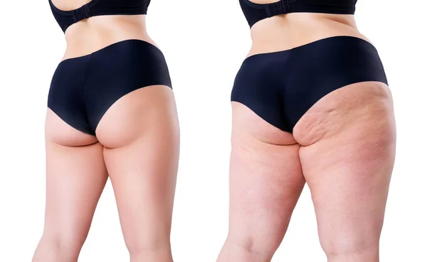 Υπέρβαρη γυναίκα με χοντρά πόδια και γλουτούς, πριν από την έννοια απώλεια βάρους απομονώνονται σε λευκό φόντο — Φωτογραφία Αρχείου
