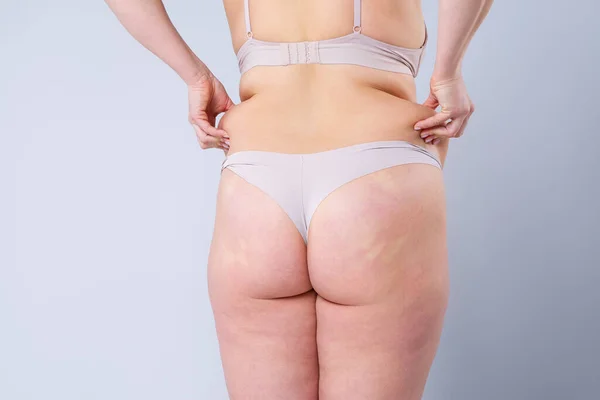 Overweight woman with fat hips and buttocks, obesity female body on gray background, studio shot