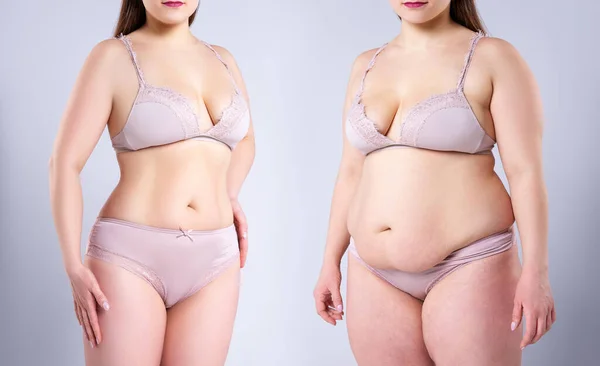 Woman Body Weight Loss Gray Background Plastic Surgery Concept — Stock Photo, Image