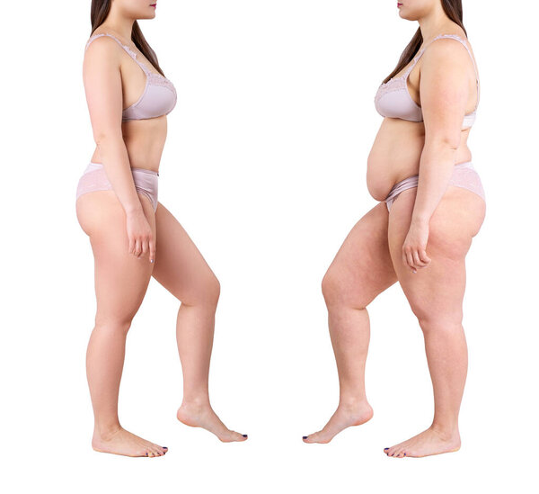 Woman's body before and after weight loss isolated on white background, plastic surgery concept