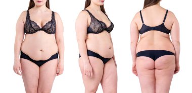 Göbeğinde ve sırtında sarkık bir deri, beyaz arka planda izole edilmiş plastik cerrahi konsepti, her taraftan birçok fotoğrafın kolajı.