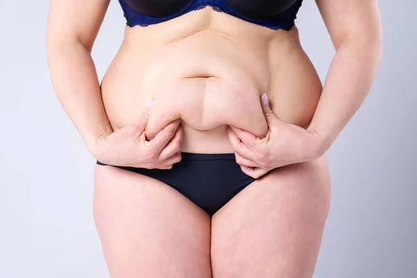 Tummy Tuck Flabby Skin Fat Belly Plastic Surgery Concept Gray — Stock Photo, Image