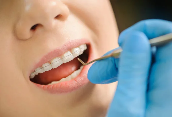 Frau mit Keramikzahnspange in der Zahnarztpraxis — Stockfoto