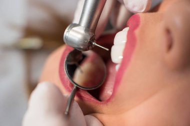 Araçları ile hasta bir diş tedavisi diş hekimi 