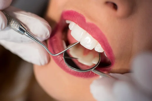 Mujer sometida a chequeo dental — Foto de Stock