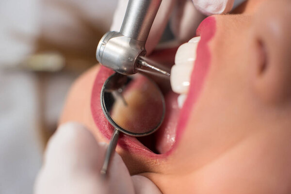 Dentist treating a patient teeth with tools 