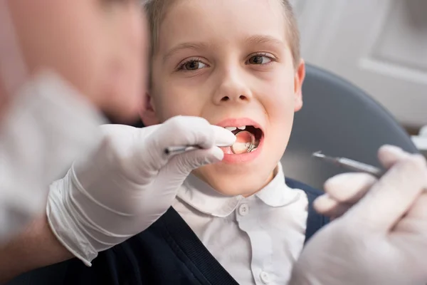 Zahnarzt aus nächster Nähe, der die Zähne des Jungen in der Zahnklinik mit Zahnwerkzeugen - Sonde und Spiegel - untersucht. Zahnmedizin — Stockfoto