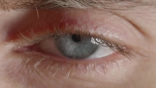 Starker Wimpernschlag eines jungen Menschen im Makro — Stockvideo