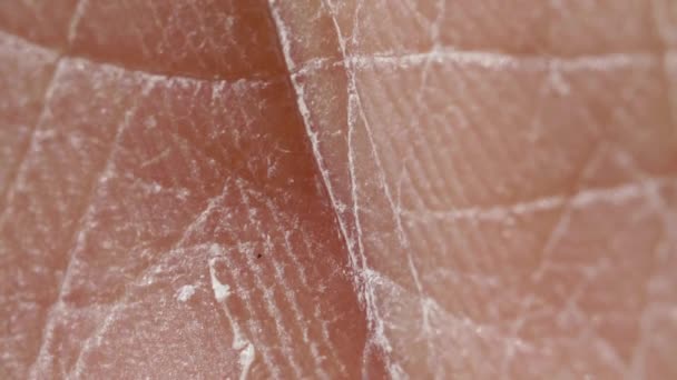 White detailed caucasian human skin closeup in macro — Stock Video