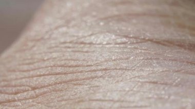Beyaz, beyaz, beyaz, beyaz, beyaz insan derisi, makroda yakın plan.