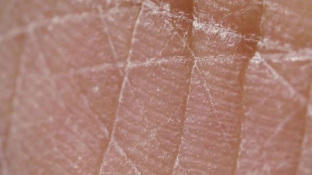 Blanc détaillée caucasien peau humaine gros plan dans macro 