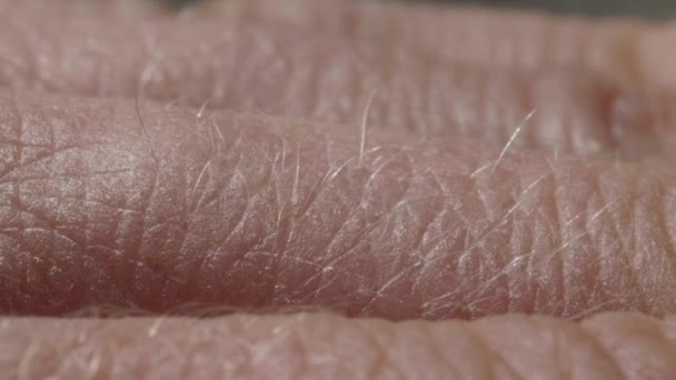 White detailed caucasian human skin on hand fingers closeup in macro — Stock Video