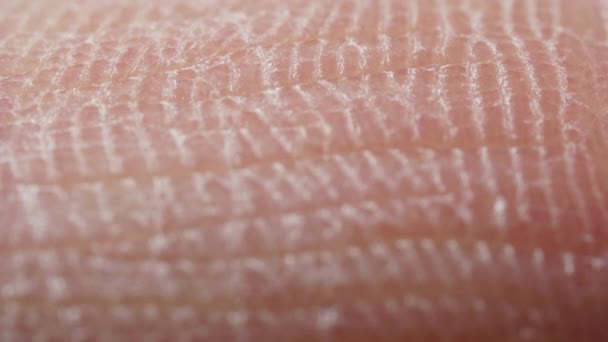 White detailed caucasian human skin closeup in macro — Stock Video