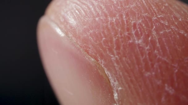 Detailed finger of white caucasian person in macro — Stock Video