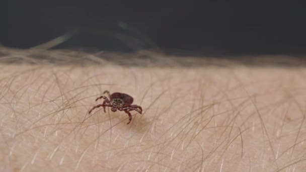 Blutsaugende Milbenzecke kriecht durch die Haare auf die menschliche Haut — Stockvideo