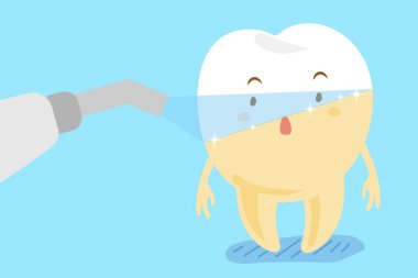 lazer diş beyazlatma konsepti ile