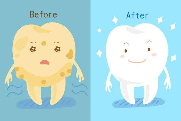 Blanqueamiento dental antes y después — Vector de stock