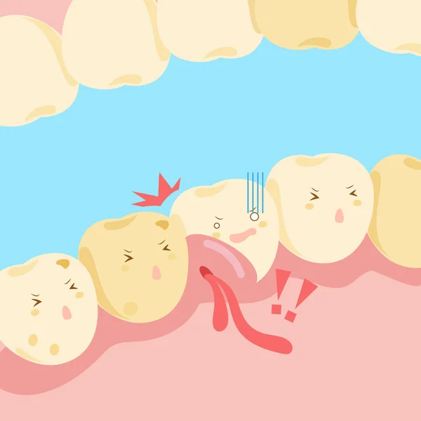 Dente de desenho animado com inchaço gengival —  Vetores de Stock