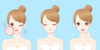 sivilce sorunu olan kadın