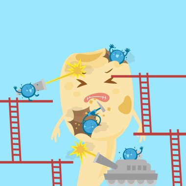  Süt diş çürümesi problem ile