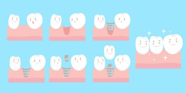 çizgi film diş implantı gülümseme mutlu