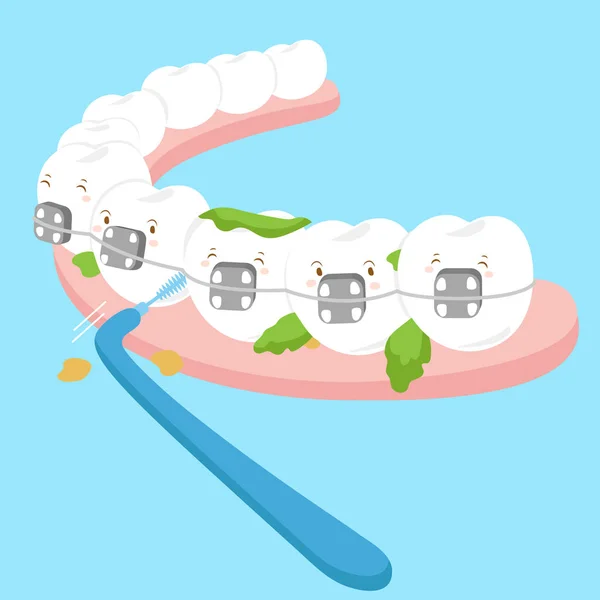 Attelle d'usure des dents avec brosse — Image vectorielle