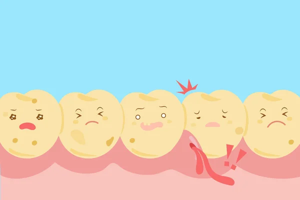 만화 치아 부패 문제 — 스톡 벡터