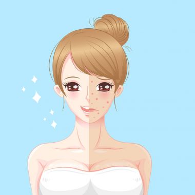 Cilt Bakımı sorunu olan kadın