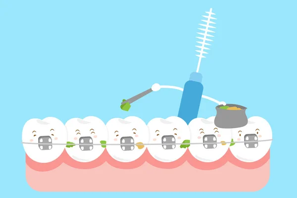 Corsé de desgaste dental con cepillo — Vector de stock