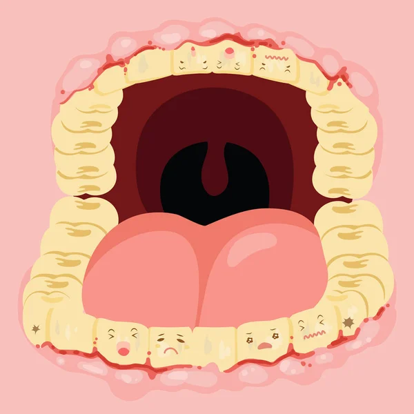 Zubní kaz problém — Stockový vektor
