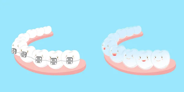 Zub nosit různé ortézy — Stockový vektor