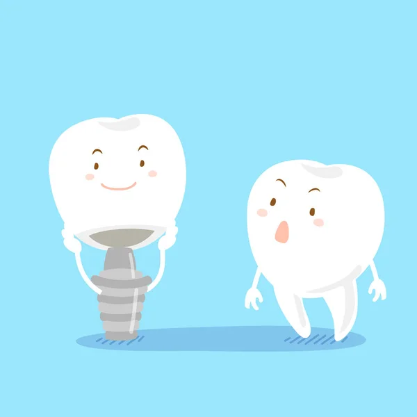 Tooth met implantaat — Stockvector