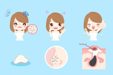 sivilce sorunu olan kadın