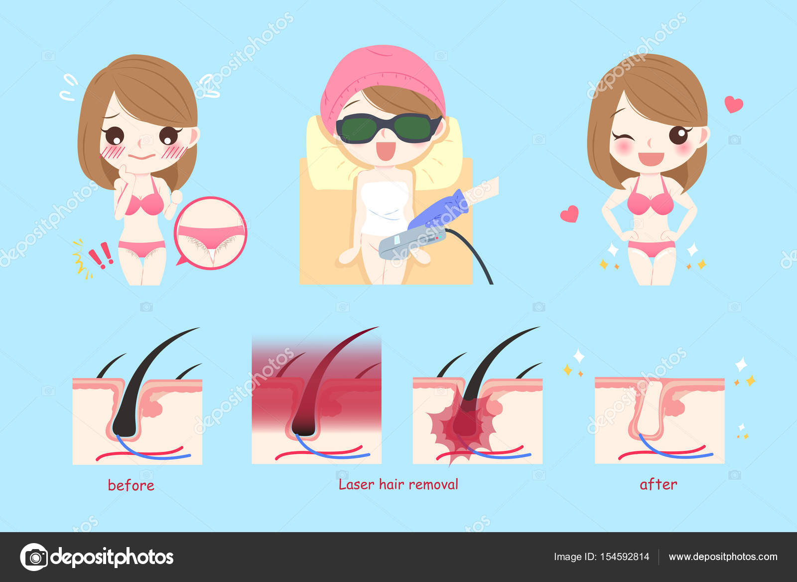 Laser hair removal Vector Art Stock Images | Depositphotos