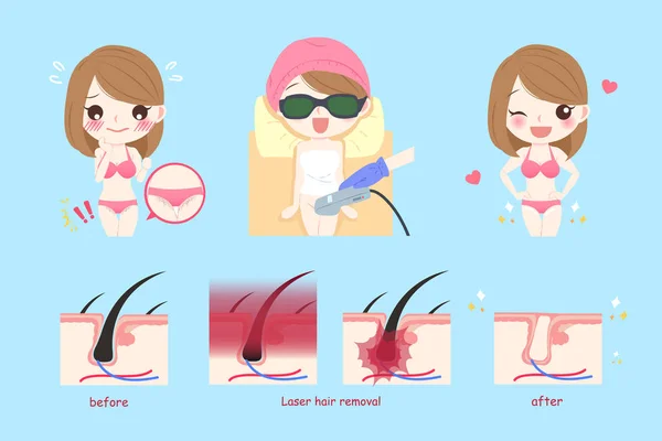 Concepto de pelo línea bikini láser — Vector de stock