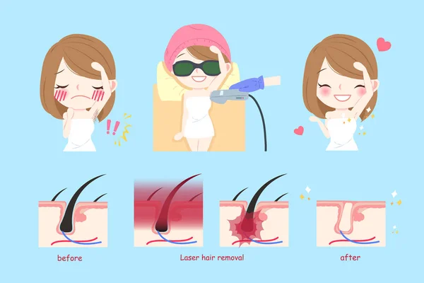 Concetto di capelli laser ascella — Vettoriale Stock